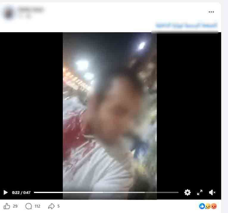 خلاف على بيع كلب يشعل مشاجرة ساخنة وتتسبب فى إصابة تاجر بحدائق القبة 