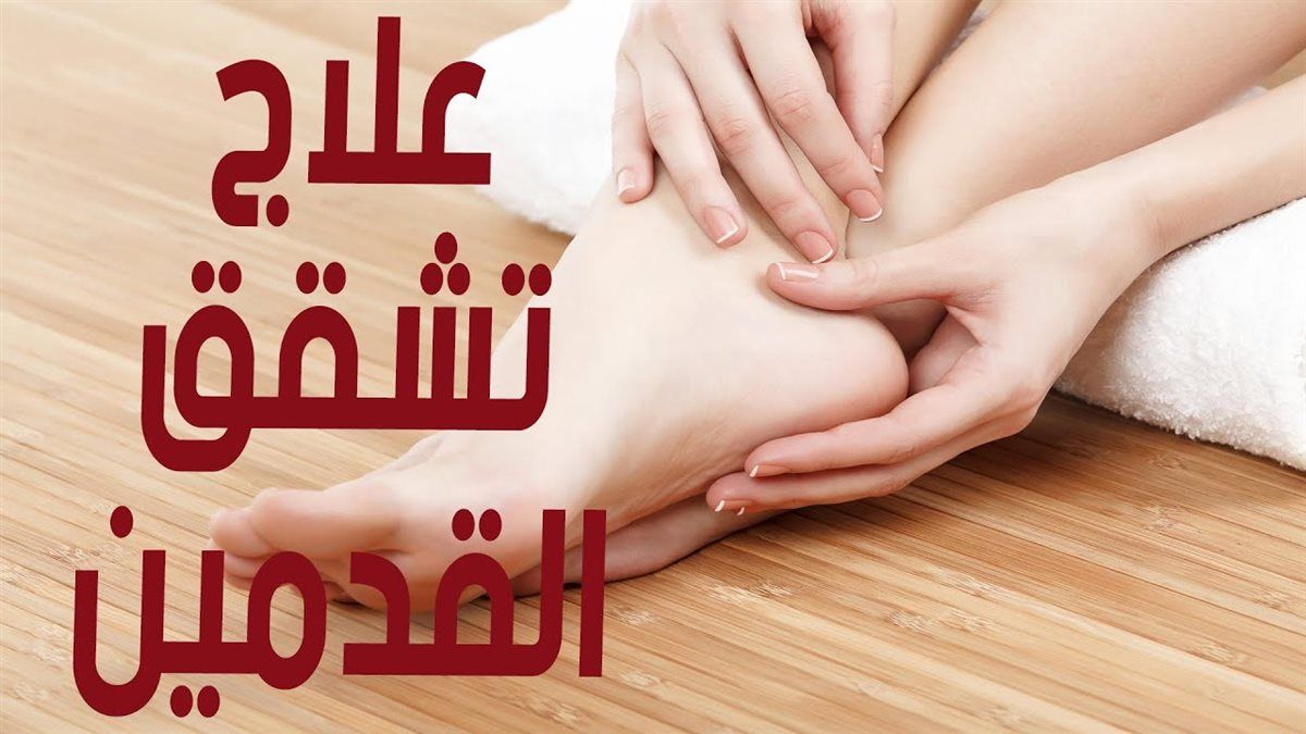 علاج تشققات القدمين