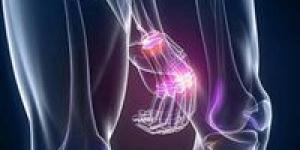 أسباب وأعراض التهاب المفاصل.. الحل الطبي الفعّال لحماية الحركة من التآكل