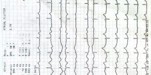 بالمستندات اتحاد الجمباز يكشف حقيقة إصابة سلمى المنشاوي