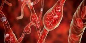 تحذيرات علمية دولية.. عامل بيئي خفي وراء ارتفاع ضغط الدم