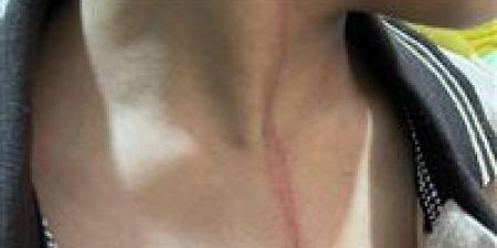 تحقيق عاجل في واقعة تعدٍ على تلميذ داخل مدرسة بميت غمر في الدقهلية