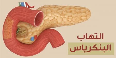 أعراض التهاب البنكرياس، استشاري باطنة يوضح ويحذر من إهمالها - النيل نيوز