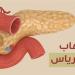 أعراض التهاب البنكرياس، استشاري باطنة يوضح ويحذر من إهمالها - النيل نيوز