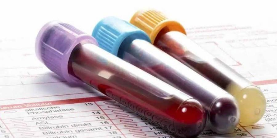 بعد سن الأربعين.. لا تتجاهل هذه التحاليل الستة قد تنقذك من أزمات مفاجئة