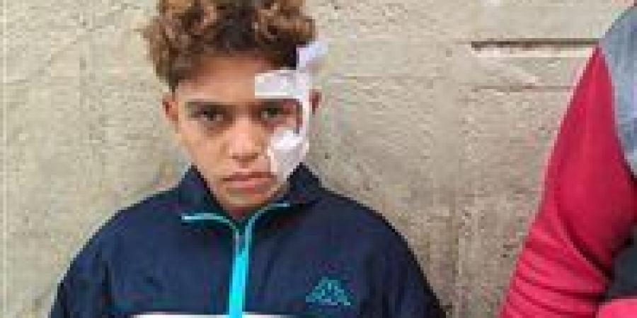 خلاف على «عجلة» ينتهي بإصابة طفل بقرية البيوم بالشرقية