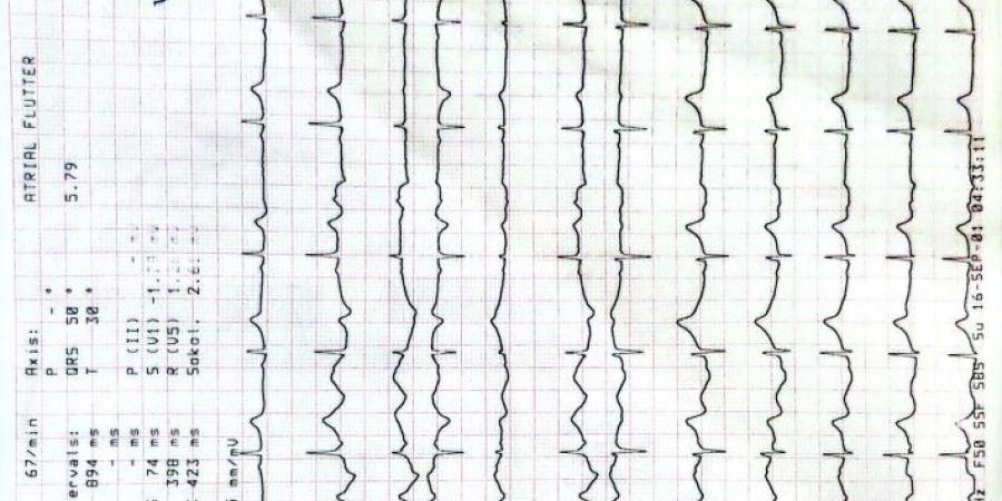 بالمستندات اتحاد الجمباز يكشف حقيقة إصابة سلمى المنشاوي