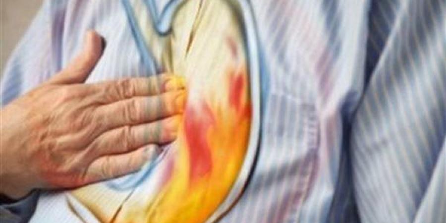 أسباب الإصابة بحموضة المعدة وطرق العلاج والوقاية