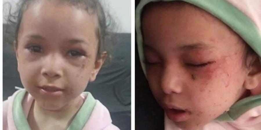 شغلت الأغاني وهي بتقتلها، حكاية الطفلة بسملة التي عادت من الموت بالمنيا