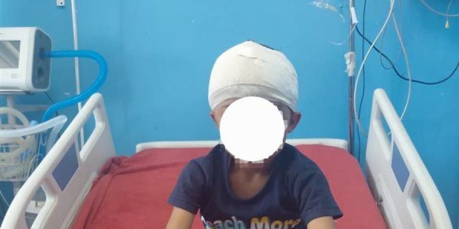 معجزة طبية في سوهاج.. استخراج رصاصة من مخ طفل وإنقاذه دون مضاعفات