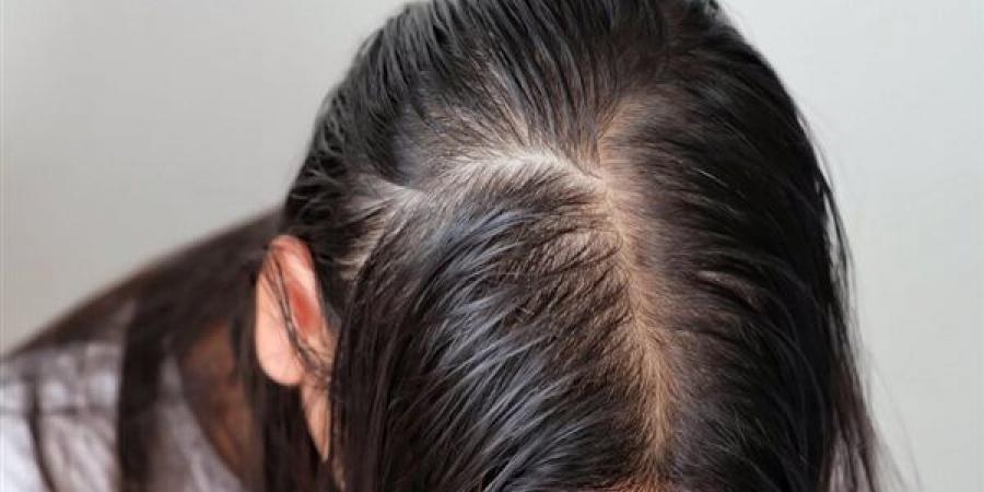 سيروم القرنفل لتقوية الشعر وإعادة انباته